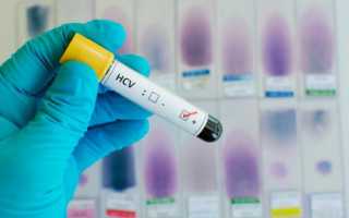 Анализ Anti-HCV total: что значит положительный и отрицательный результат