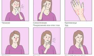 Аллергия на домашнюю пыль и другие ее виды