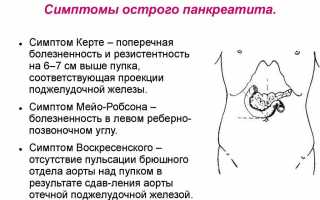 Когда живот кричит: как быстро и точно распознать острый панкреатит