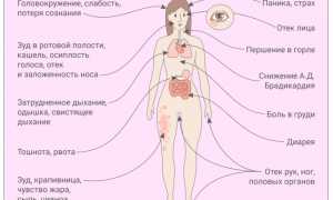 Особенности проявления аллергии на молоко у взрослых и детей