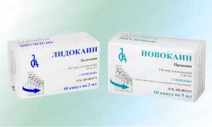 Аллергия на Новокаин — причины и симптомы