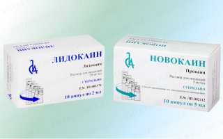 Аллергия на Новокаин — причины и симптомы