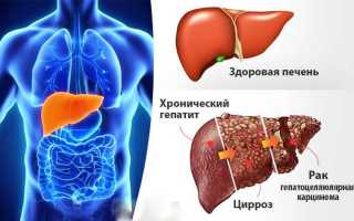 Все что нужно знать о заболеваниях печени