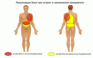 Почему при панкреатита может болеть спина и поясница?