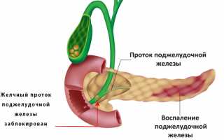 Как правильно использовать овес при панреатите?