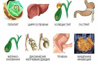 Методы лечения панкреатита и холецистита