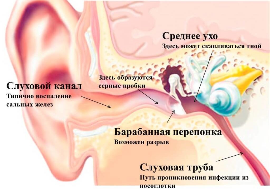 Отипакс должен назначить ЛОР после осмотра