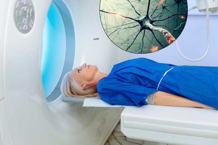 заболевание цнс