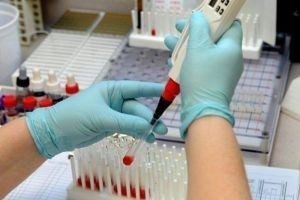 МНО анализ крови : норма