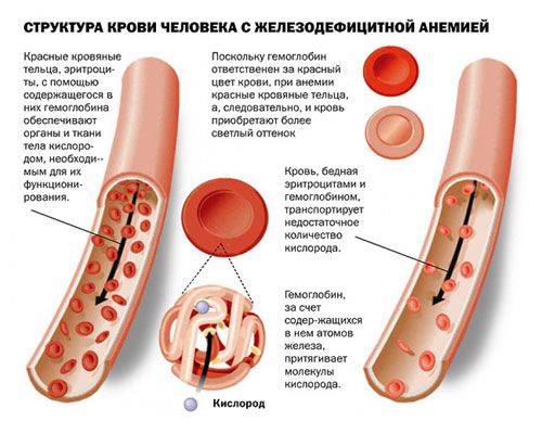 понижен гемоглобин