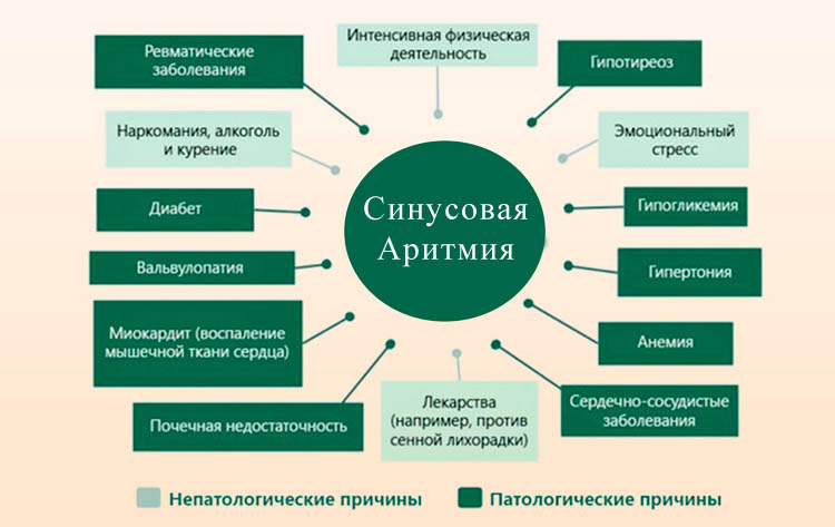 препараты от аритмии