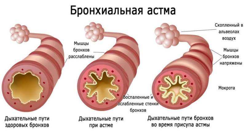 эуфиллин при астме