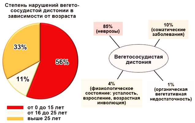 vsd