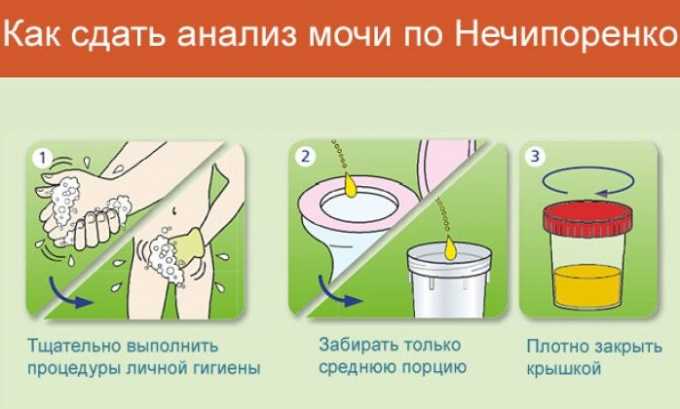 Анализ необходимо доставить в лабораторию сразу после сбора. Прием проводится по утрам. Результаты анализа получают на следующий день