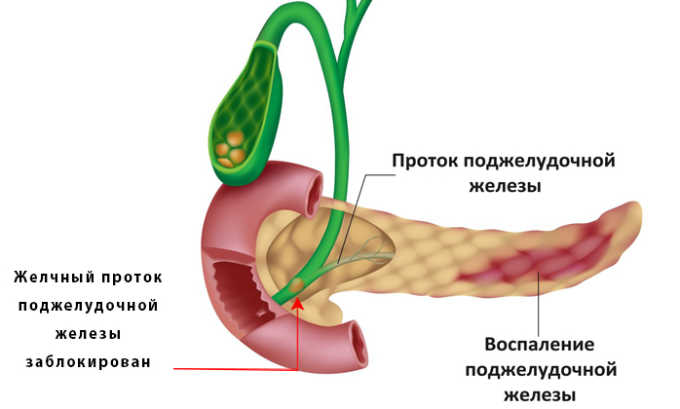 Воспаление поможет снять ромашка