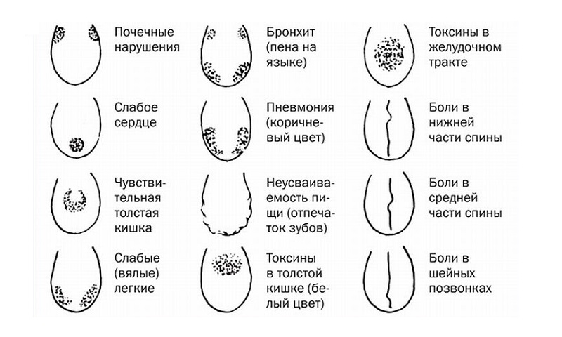 У здорового человека язык имеет ровный, бледно-розовый оттенок, что свидетельствует о правильно работающей пищеварительной системе