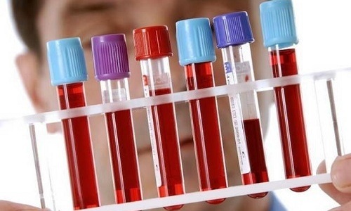 Для выявления панкреонекроза применяют анализ крови на уровень трипсина, альфа-амилазы, эластазы, холестеролэстеразы