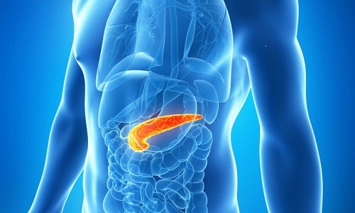 Панкреатитом называется воспалительное поражение поджелудочной железы, которое может протекать остро или хронически