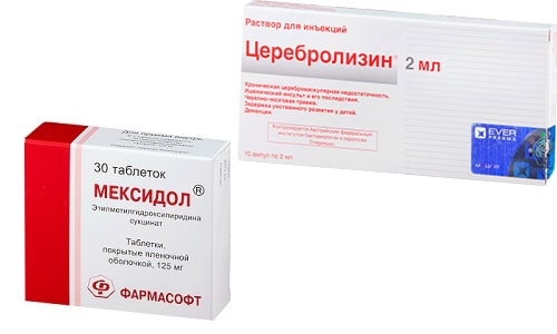 Мексидол и Церебролизин принимают при нарушении мозгового кровообращения, сопровождающегося мигренью, головокружением и расстройством памяти