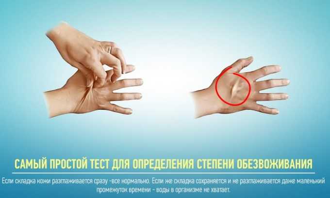 Дефицит влаги при панкреатите может спровоцировать дегидратацию