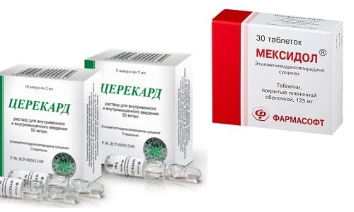 Церекард и Мексидол используют для лечения неврологических заболеваний