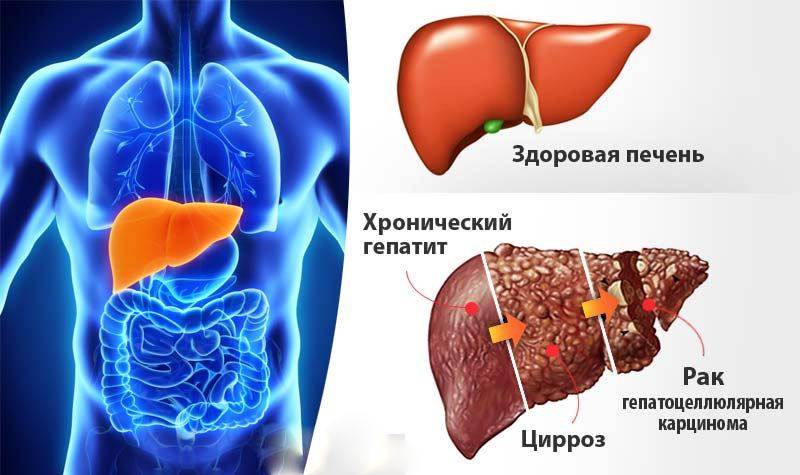 Все что нужно знать о заболеваниях печени