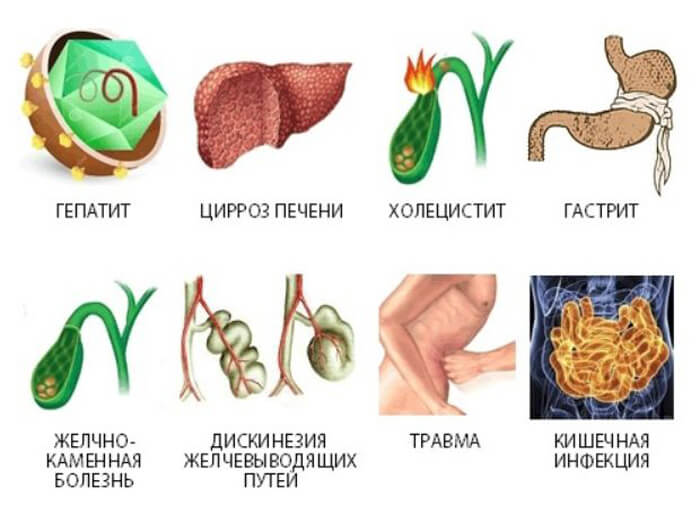 Методы лечения панкреатита и холецистита
