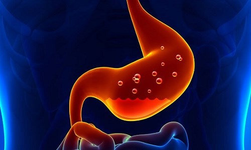 При гастрите пациента переводят на диету № 1А, во время которой ограничено употребление белков и жиров